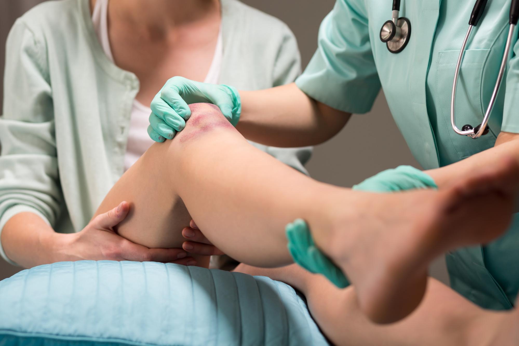 Doctor assisting a woman with a bruised knee