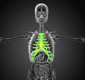 Broken Sternum Car Accident Settlement